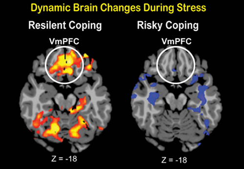 Jul20_2016_Yale_InteriorBrain1008819967-1.jpg