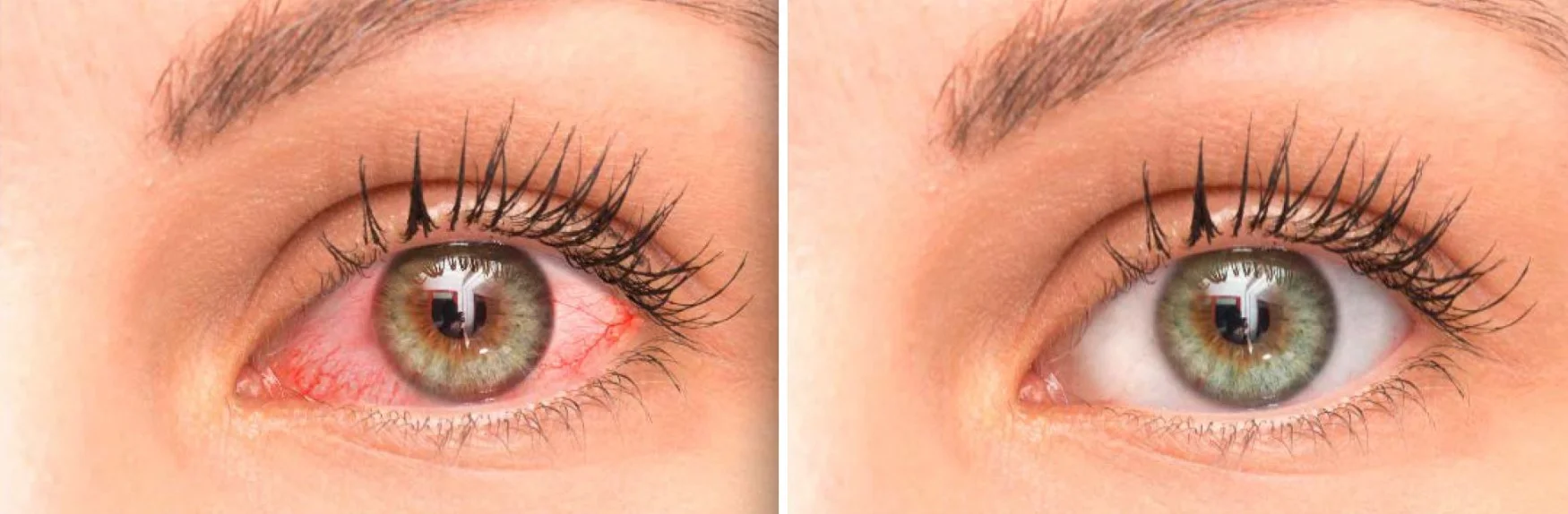 eyes-1750x574.webp