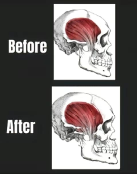 1000076890