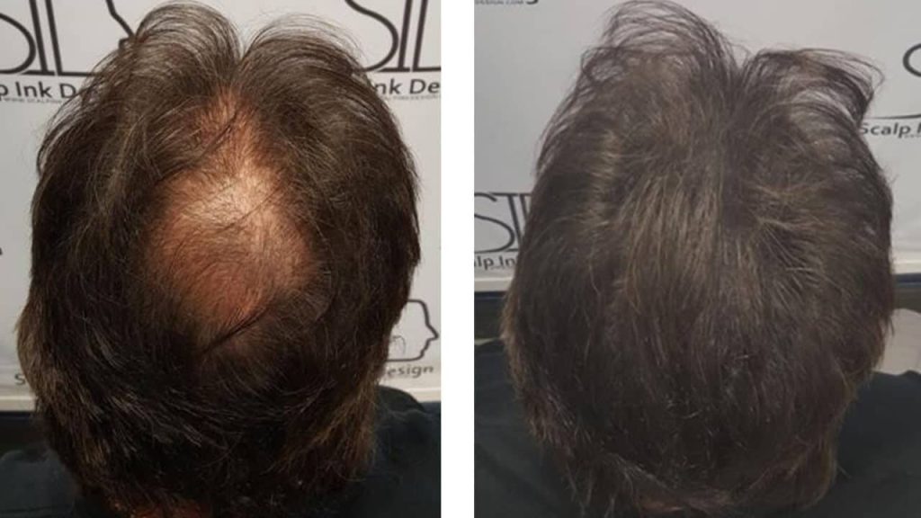 HAIR-DENSITY4-1024x576.jpg